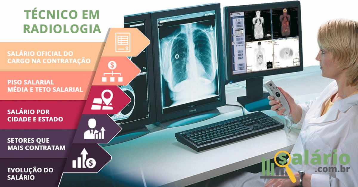 Salário e mercado de trabalho para Técnico em Radiologia – Salário – Rio de Janeiro, RJ